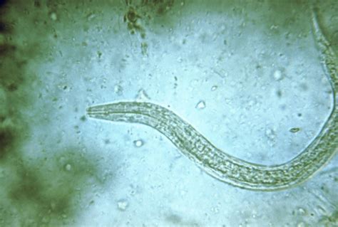 Hookworms in Humans: Signs, Transmission, Prevention