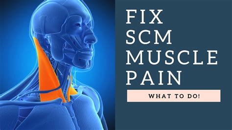 FIX Sternocleidomastoid (SCM) Muscle Neck Pain, Headaches & Jaw Pain With This Stretch! - YouTube