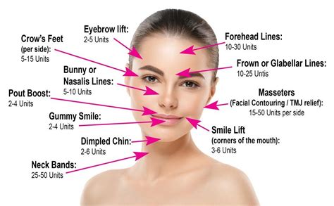 Printable Botox Injection Face Map - Printable Templates