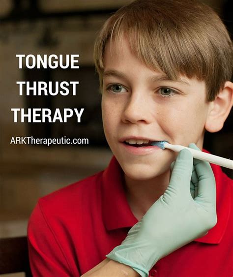 Tongue Thrust Therapy | Preschool speech therapy, Tongue thrust, Speech ...