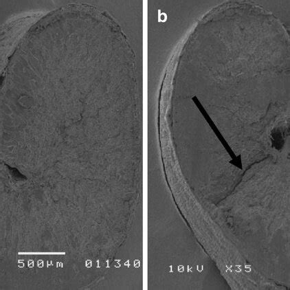 Exemplary scanning picture of wheat grain: a intact grain, b grain ...