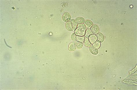 Module 8.4: Common Structures Observed on the Sediment Exam – Clinical Veterinary Diagnostic ...