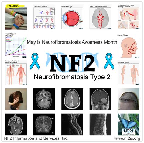 Pin on Neuropsychology