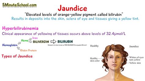 WHAT IS JAUNDICE? - SIMPLE EXPLANATION OF 3 MAIN CAUSES - YouTube