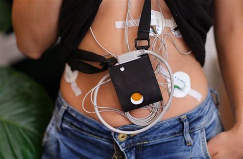 What Does A Holter Monitor Do | Robots.net