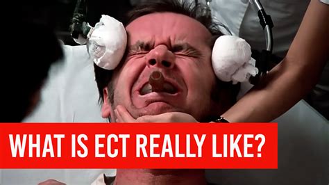 Electroconvulsive Therapy (ECT) - What is it really like?