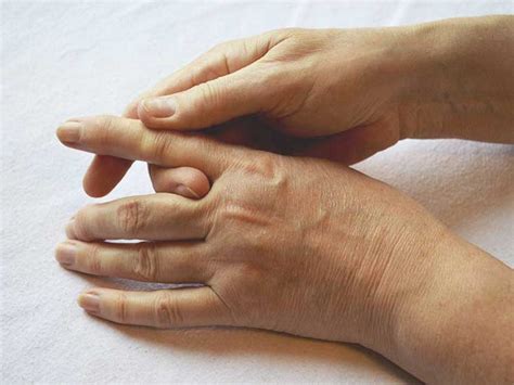 Trigger Finger Surgery: Recovery, Procedure, and More