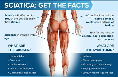 Sciatica: “Why Does My Back Problem Cause Such Severe Leg Pain?"