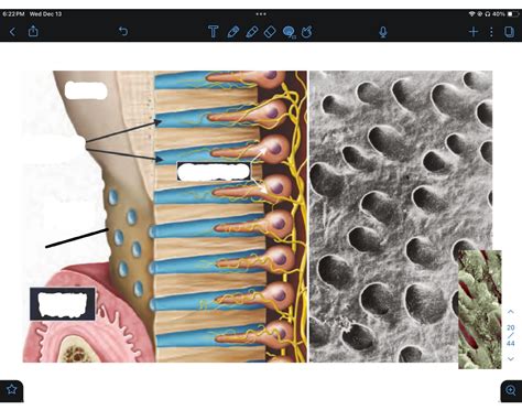 dentinal tubules lateral view Quiz