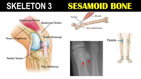 What'S The Largest Sesamoid Bone? Top Answer Update - Ecurrencythailand.com