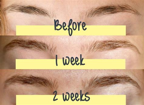 Brow Growth Serum | Brow growth serum, Brow growth, How to grow eyebrows