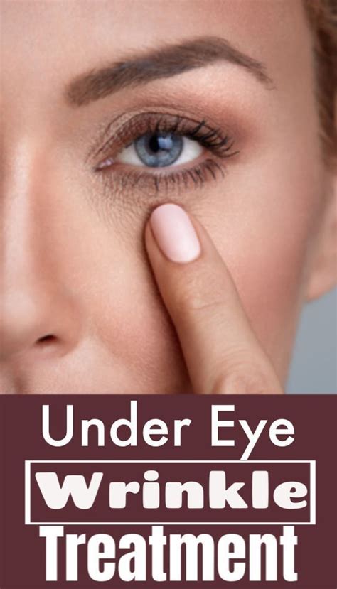 How to get rid of wrinkles under eyes ! | Under eye wrinkles, Home remedies for wrinkles, Eye ...