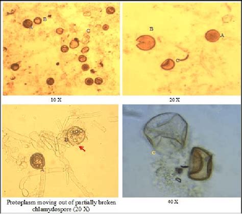 Chlamydospores suspended in isotonic buffer A-Viable chlamydospore,... | Download Scientific Diagram