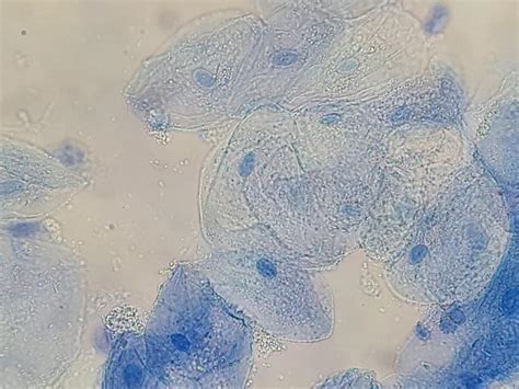 Cheek Cells Under the Microscope