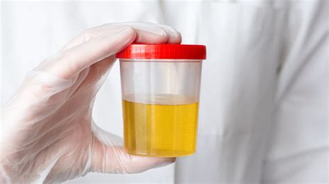 DOT Urine Specimen Collection Guidelines & Procedure | Importance & More