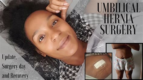 UMBILICAL HERNIA SURGERY || UPDATE AND PICTURES - YouTube