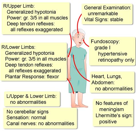 Cervical Epidural Hematoma - Interactive case study | Clinical Odyssey by Medical Joyworks, LLC