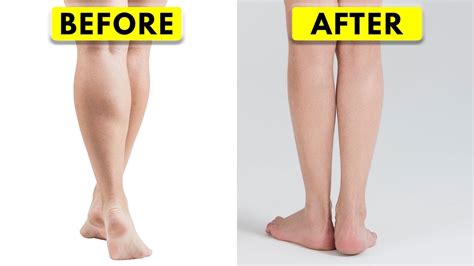 How To Get Rid Of Large Calves - Memberfeeling16