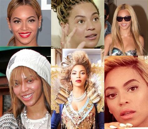 Beyonce Skin Bleaching Before and After | Beyonce skin, Skin bleaching, Skin acne treatment