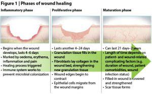 Stages Of Soft Tissue Healing • Bodybuilding Wizard