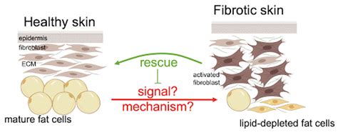 Skin Fibrosis | Atit Lab | Case Western Reserve University