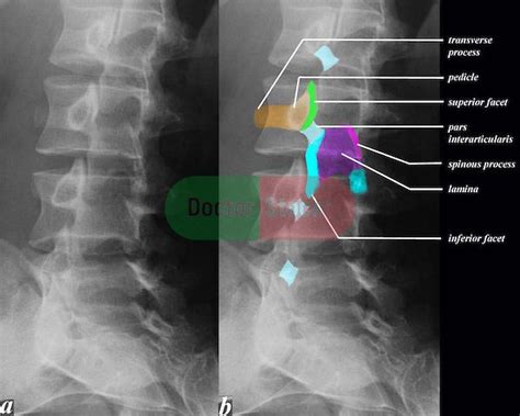 ps59074DS.JPG | Doctor Stock | Radiology humor, Radiology schools, Radiology student