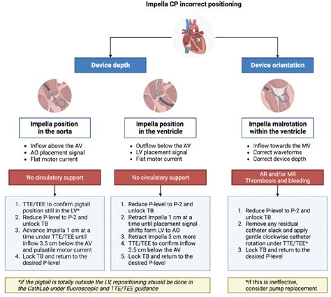 Technical Tips for Inserting and Positioning the Impella Device - Cardiac Interventions Today