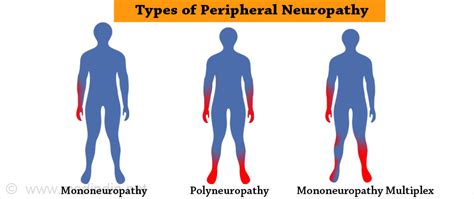 Numbness of the Hands - Legacy Spine & Neurological Specialists