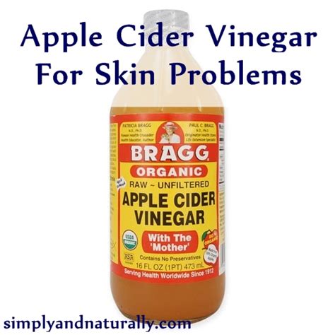 Apple Cider Vinegar For Skin Problems - Simply and Naturally