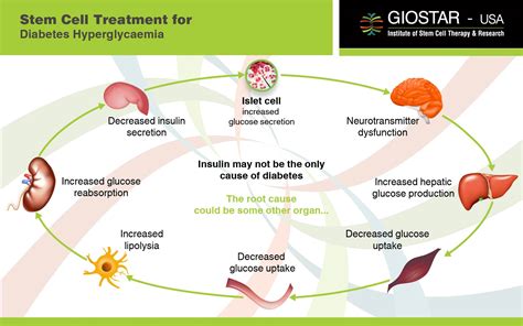 Diabetes Type 1 Treatment in India, Stem Cell Therapy for Diabetes Type 1