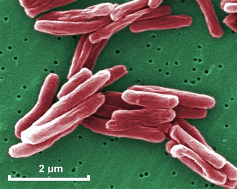 Mycobacterium tuberculosis electron microscopy. SEM micrograph of M.tuberculosis.