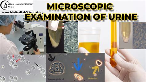 MICROSCOPIC URINALYSIS - Medical Laboratory Scientist MLS