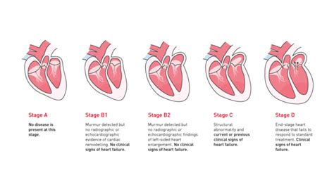 What Are The Stages Of Heart Failure In Dogs