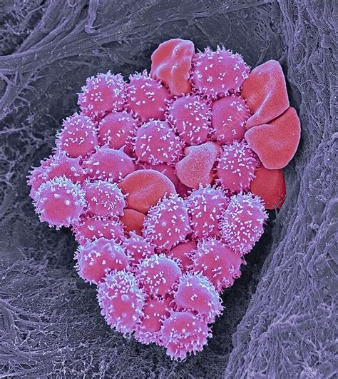 Crenate red blood cells, SEM - Stock Image - C049/2779 - Science Photo Library