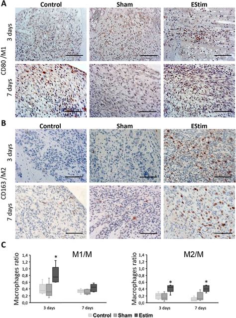 Immunohistochemistry analysis of CD80 (marker for M1 macrophages) and ...