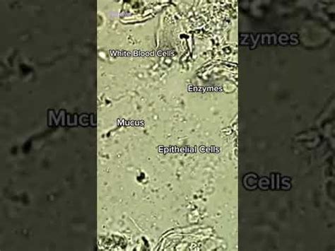 Bacteria In Saliva Under Microscope (Human Spit) - YouTube