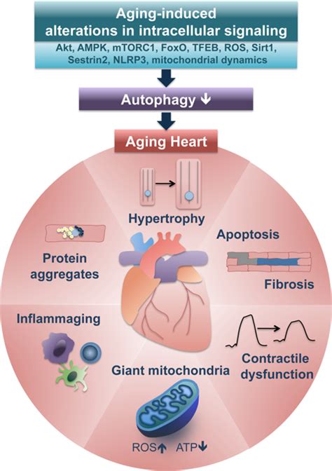 Autophagy Cell Death