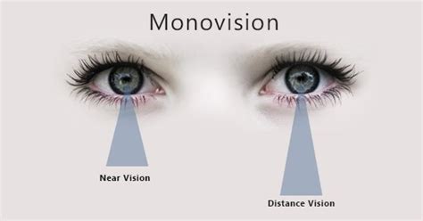 Vision Source Westview: Monovision Contact Lenses in Bunker Hill and ...