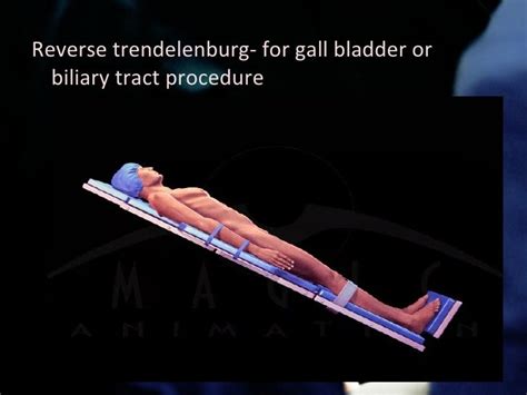 Concept On Surgery Intra Operative