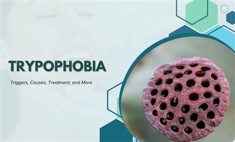 Trypophobia: Triggers, Causes, Treatment, and More - Resurchify