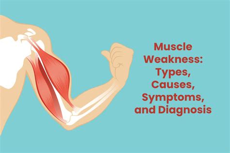 Muscle Weakness: Types, Causes, Symptoms, and Diagnosis - SBH