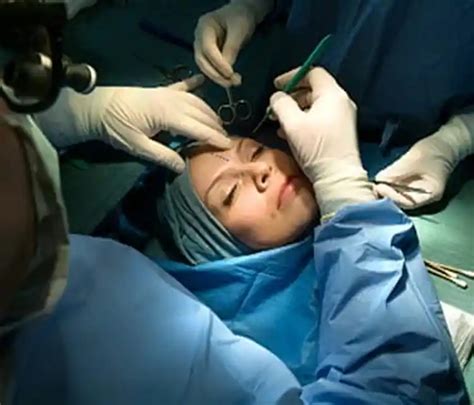 Anesthesia and Other Risks of Cosmetic Surgery - Watch WebMD Video