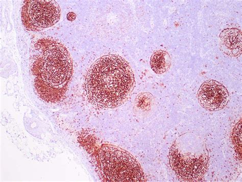 CD23 Monoclonal Antibody (ZM209) (Z2545MS)