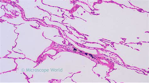 Microscope World Blog: Human Lungs under the Microscope