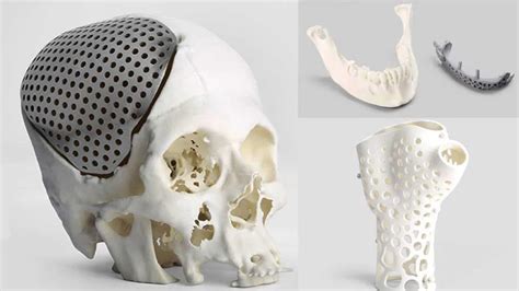 3D Printed Bones: The Most Jaw-Dropping Projects in 2020 | All3DP | Prints, 3d printing ...