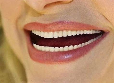 23 Fotos, die dir unangenehmer sind, als du zugeben willst | Cursed images, Meme faces, Teeth