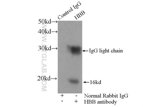 HBB antibody (16216-1-AP) | Proteintech