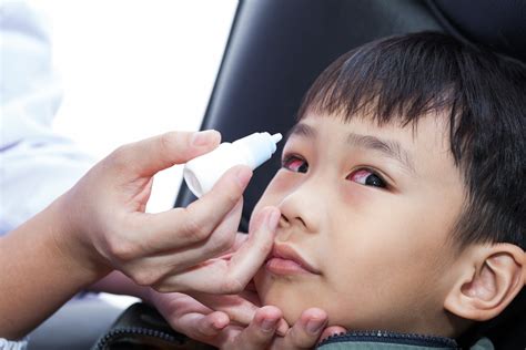 What To Do If Your Child Has Pink Eye | Optometrist Edmonton