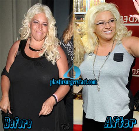 Beth Chapman Plastic Surgery Secrets Revealed