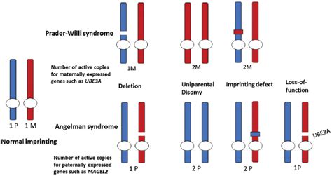 Angelman Syndrome 10 Angelman Syndrome Symptoms